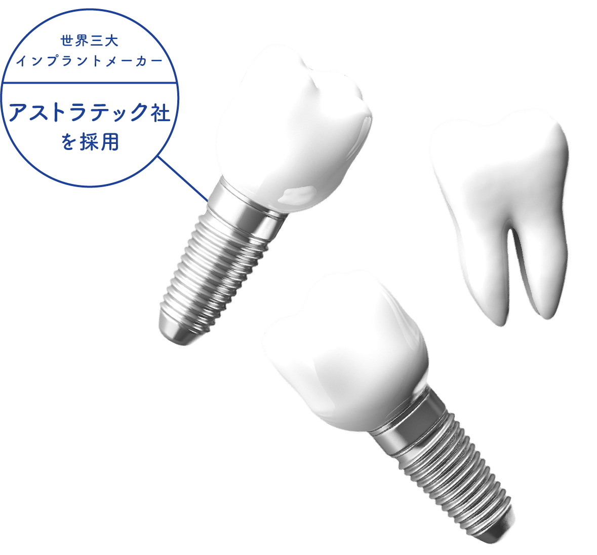 ゆう歯科クリニックのインプラント治療