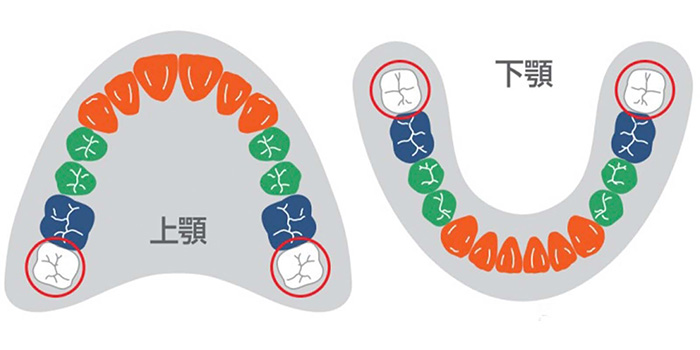 保険適用の白い歯には条件があります