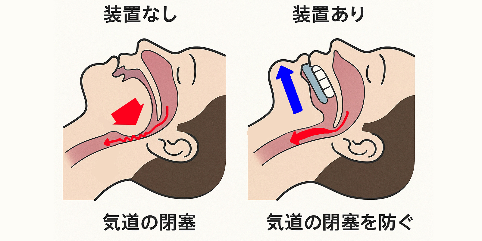 スリープスプリント